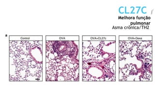Melhora função
pulmonar
CL27C
Asma crônica/TH2
 