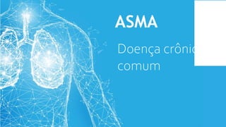 ASMA
Doença crônica
comum
 