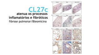 CL27c
atenua os processos
inflamatórios e fibróticos
fibrose pulmonar/Bleomicina
 