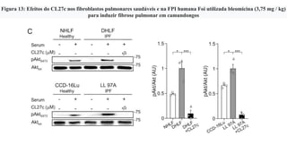 Figura 13: Efeitos do CL27c nos fibroblastos pulmonares saudáveis ​​e na FPI humana Foi utilizada bleomicina (3,75 mg / kg)
para induzir fibrose pulmonar em camundongos
 
