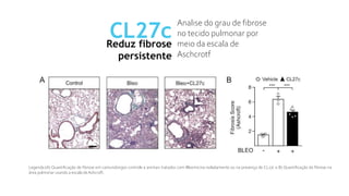 CL27c
Reduz fibrose
persistente
Analise do grau de fibrose
no tecido pulmonar por
meio da escala de
Aschcrotf
Legenda:(A) Quantificação de fibrose em camundongos controle e animais tratados com Bleomicina isoladamente ou na presença de CL27c e B) Quantificação da fibrose na
área pulmonar usando a escala deAshcroft.
 