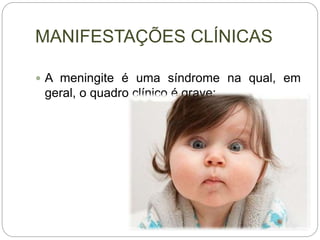 MANIFESTAÇÕES CLÍNICAS
 A meningite é uma síndrome na qual, em
geral, o quadro clínico é grave;
 