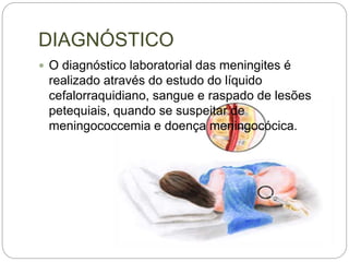 DIAGNÓSTICO
 O diagnóstico laboratorial das meningites é
realizado através do estudo do líquido
cefalorraquidiano, sangue e raspado de lesões
petequiais, quando se suspeitar de
meningococcemia e doença meningocócica.
 