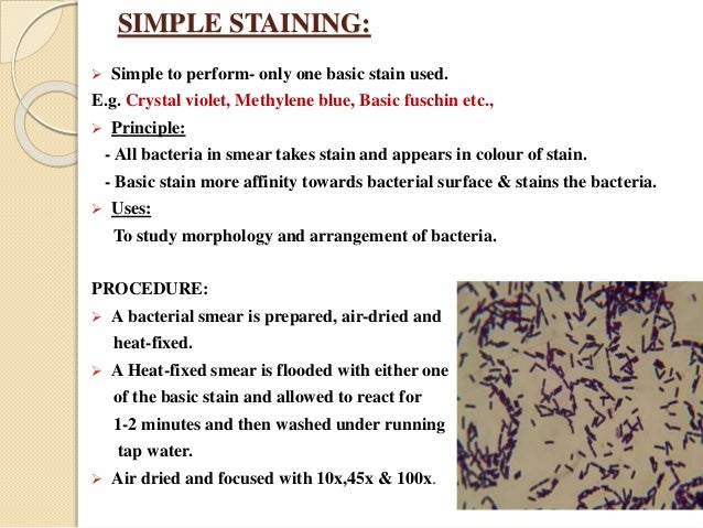 what is the fundamental theory of simple staining