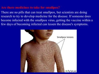 A presentaion on biological disaster | PPT