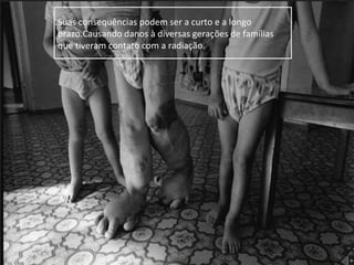 Suas consequências podem ser a curto e a longo
prazo.Causando danos à diversas gerações de famílias
que tiveram contato com a radiação.
 