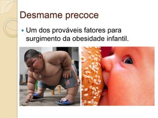 Desmame precoce


Um dos prováveis fatores para
surgimento da obesidade infantil.

 