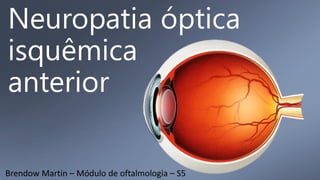 Neuropatia óptica
isquêmica
anterior
Brendow Martin – Módulo de oftalmologia – S5
 