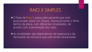 RAIO X SIMPLES
O feixe de Raio X passa pelo paciente que está
posicionado sobre um chassis, impressionando o filme
dentro da placa, com diferentes tonalidades, de
acordo com a penetração dos raios.
As tonalidades são dependentes da espessura e da
densidade da estrutura que está sendo atravessada.
 
