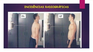 INCIDÊNCIAS RADIOGRÁFICAS
 