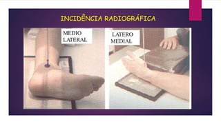 INCIDÊNCIA RADIOGRÁFICA
 