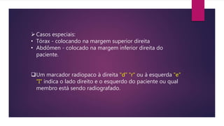 Casos especiais:
• Tórax - colocando na margem superior direita
• Abdômen - colocado na margem inferior direita do
paciente.
Um marcador radiopaco à direita "d" "r" ou à esquerda "e"
"I" indica o lado direito e o esquerdo do paciente ou qual
membro está sendo radiografado.
 