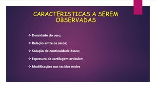 CARACTERISTICAS A SEREM
OBSERVADAS
 Densidade do osso;
 Relação entre os ossos;
 Solução de continuidade óssea;
 Espessura da cartilagem articular;
 Modificações nos tecidos moles
 