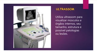 ULTRASSOM
Utiliza ultrassom para
visualizar músculos e
órgãos internos, seu
tamanho, estrutura e
possível patologias
ou lesões.
 