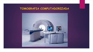 TOMOGRAFIA COMPUTADORIZADA
 
