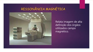 RESSONÂNCIA MAGNÉTICA
Relata imagem de alta
definição dos órgãos
utilizados campo
magnético.
 