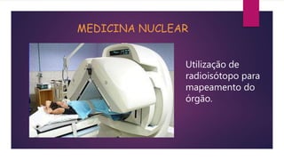 MEDICINA NUCLEAR
Utilização de
radioisótopo para
mapeamento do
órgão.
 
