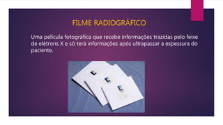 FILME RADIOGRÁFICO
Uma película fotográfica que recebe informações trazidas pelo feixe
de elétrons X e só terá informações após ultrapassar a espessura do
paciente.
 