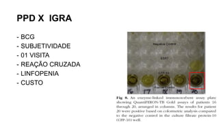 PPD X IGRA
- BCG
- SUBJETIVIDADE
- 01 VISITA
- REAÇÃO CRUZADA
- LINFOPENIA
- CUSTO
 