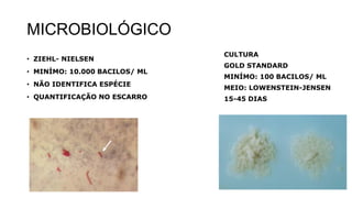 MICROBIOLÓGICO
• ZIEHL- NIELSEN
• MINÍMO: 10.000 BACILOS/ ML
• NÃO IDENTIFICA ESPÉCIE
• QUANTIFICAÇÃO NO ESCARRO
CULTURA
GOLD STANDARD
MINÍMO: 100 BACILOS/ ML
MEIO: LOWENSTEIN-JENSEN
15-45 DIAS
 