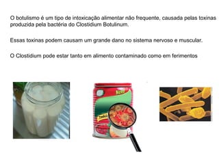 O botulismo é um tipo de intoxicação alimentar não frequente, causada pelas toxinas produzida pela bactéria do Clostidium Botulinum.  Essas toxinas podem causam um grande dano no sistema nervoso e muscular.  O Clostidium pode estar tanto em alimento contaminado como em ferimentos  