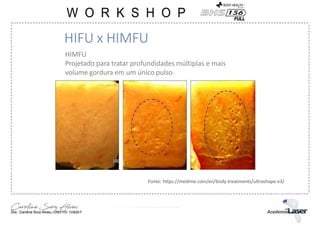 HIMFU
Projetado para tratar profundidades múltiplas e mais
volume gordura em um único pulso
HIFU x HIMFU
Fonte: https://medime.com/en/body-treatments/ultrashape-v3/
 