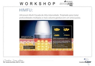 Ultrassom Multi Focado de Alta Intensidade Projetado para tratar
profundidades múltiplas e mais volume gordura em um único pulso.
HIMFU:
 
