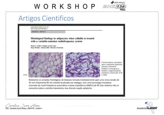Artigos Cientificos
Relatamos os achados histológicos de biópsias tomada imediatamente após uma única sessão de
45 min tratamento RF, em celulite localizada nas nádegas, com uma tecnologia inovadora
chamado de multi-frequência automática e baixa impedância (AMFLI) de RF.Este relatório não se
concentra sobre a celulite tratamento, mas discute reação adipócito.
 