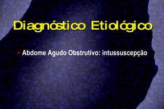 Diagnóstico Etiológico Abdome Agudo Obstrutivo: intussuscepção 