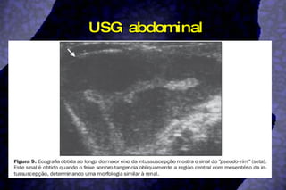 USG abdominal 
