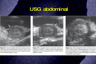 USG abdominal 