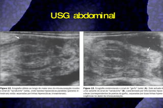 USG abdominal 