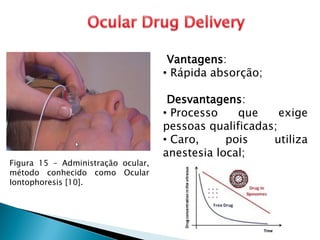 Figura 15 – Administração ocular,
método conhecido como Ocular
Iontophoresis [10].
Vantagens:
• Rápida absorção;
Desvantagens:
• Processo que exige
pessoas qualificadas;
• Caro, pois utiliza
anestesia local;
 