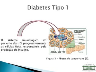 Figura 3 – Ilhotas de Langerhans [2].
O sistema imunológico do
paciente destrói progressivamente
as células Beta, responsáveis pela
produção da insulina.
 