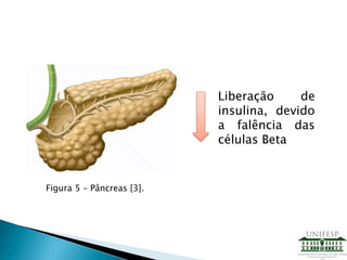 Liberação de
insulina, devido
a falência das
células Beta
Figura 5 – Pâncreas [3].
 
