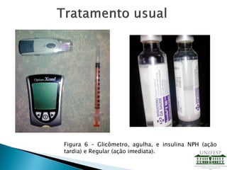 Figura 6 – Glicômetro, agulha, e insulina NPH (ação
tardia) e Regular (ação imediata).
 
