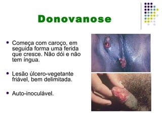 Donovanose

   Começa com caroço, em
    seguida forma uma ferida
    que cresce. Não dói e não
    tem íngua.

   Lesão úlcero-vegetante
    friável, bem delimitada.

   Auto-inoculável.
 