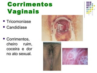 Corrimentos
Vaginais
 Tricomoníase
 Candidíase
 Corrimentos,
cheiro ruim,
coceira e dor
no ato sexual.
 