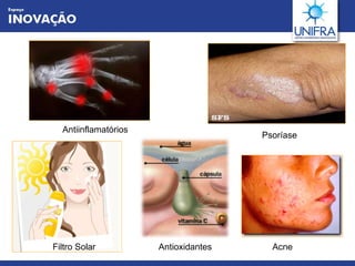 Antiinflamatórios  Acne  Psoríase Filtro Solar Antioxidantes 