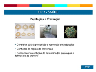 STC Patologias e Prevenção Contribuir para a prevenção e resolução de patologias Conhecer as regras de prevenção Reconhecer a evolução de determinadas patologias e formas de as prevenir UC  3 -  SAÚDE 