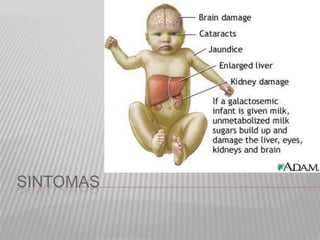 SINTOMAS

 