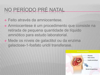 NO PERÍODO PRÉ NATAL





Feito através da amniocentese.
Amniocentese é um procedimento que consiste na
retirada de pequena quantidade de líquido
amniótico para estudo laboratorial.
Mede os níveis de galactitol ou da enzima
galactose-1-fosfato uridil transferase.

 