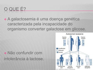 O QUE É?


A galactosemia é uma doença genética
caracterizada pela incapacidade do
organismo converter galactose em glicose.

Não confundir com
intolerância à lactose.


 