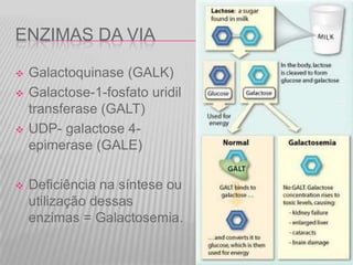 ENZIMAS DA VIA







Galactoquinase (GALK)
Galactose-1-fosfato uridil
transferase (GALT)
UDP- galactose 4epimerase (GALE)
Deficiência na síntese ou
utilização dessas
enzimas = Galactosemia.

 
