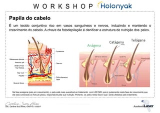 Papila do cabelo
É um tecido conjuntivo rico em vasos sanguíneos e nervos, induzindo e mantendo o
crescimento do cabelo. A chave da fotodepilação é danificar a estrutura de nutrição dos pelos.
Na fase anágena (pelo em crescimento), o pelo está mais suscetível ao tratamento com LED NIR, pois é justamente nesta fase de crescimento que
ele está conectado ao folículo piloso, responsável pela sua nutrição. Portanto, os pelos nesta fase é que serão afetados pelo tratamento.
 