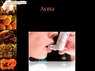 Asma A asma é uma situação anormal das vias respiratórias a nível pulmonar causada por uma grande variedade de factores a onde os Alergénio desempenham um papel muito importante. Ocorre um estreitamento das vias respiratórias dificultando a respiração.  