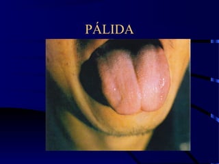 PÁLIDA
 
