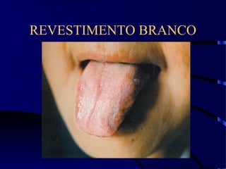 REVESTIMENTO BRANCO
 