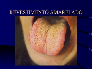 REVESTIMENTO AMARELADO
 