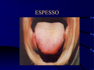ESPESSO
 